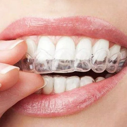 Pros And Cons Of Having Invisalign
